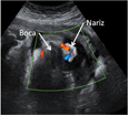 respiración fetal