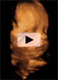 Video cara 4D rotación